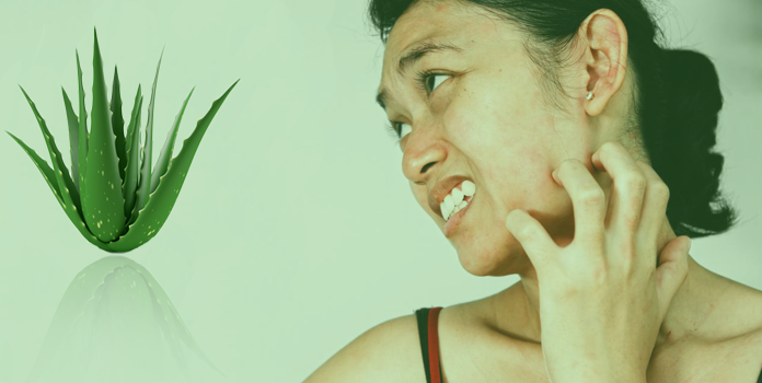 13 Aloe Vera Side Effects You Should Know Livinghours