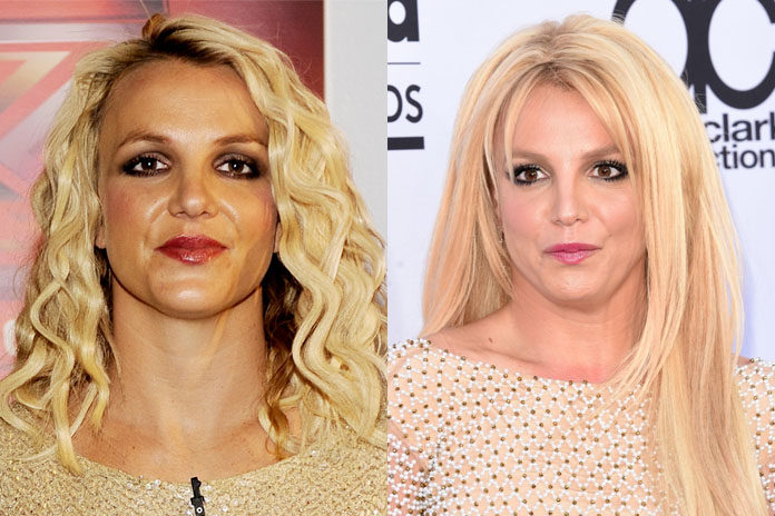 Celebrity Plastic Surgeries