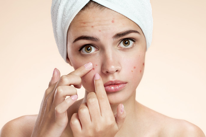 What Causes Acne