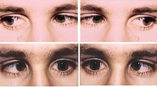 Side to side Eye movement exercise to improve your eyesight.